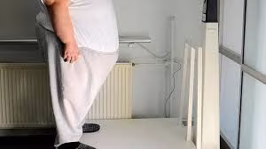 Obezitesi Olanlar Çareyi 6 Yıl Sonra Hekimde Arıyor