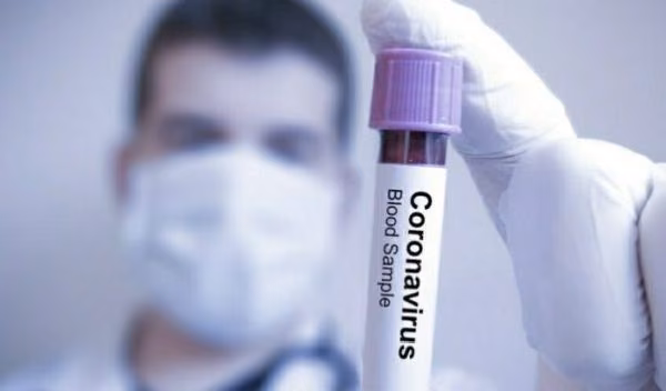 Bir Sağlık Rehberi: Yeni Tip Coronavirus COVID-19 Hakkında Her Şey!