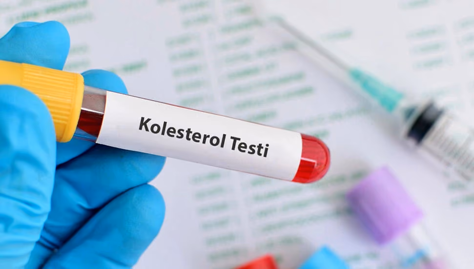 Tek Doz Gen Tedavisi Kolesterolü Bir Yıl Boyunca Yarı Yarıya Düşürdü