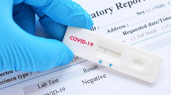 Güney Kıbrısta 24 Saat İçerisinde 2 Bin 797 Test Yapıldı Ve Yanlızca 1 Covid-19 Vakası Tespit Edildi