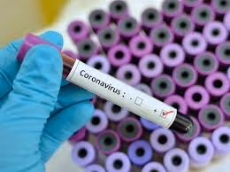 25 Koronavirüs Testi Daha Yapıldı, 1 Pozitif Vakaya Daha Rastlandı