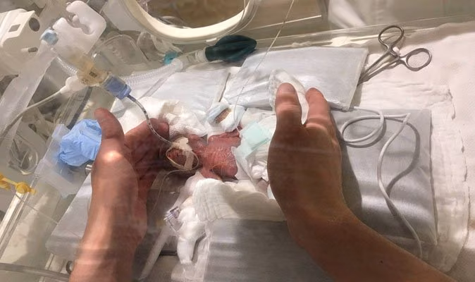 Dünyanın En Küçük Erkek Bebeği Taburcu Edildi